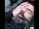 https://image.noelshack.com/fichiers/2024/02/6/1705119570-1337749-jerome-rodrigues-un-gilet-jaune-blesse-lors-des-manifestations-du-26-janvier-2019.jpg