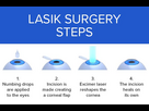 https://image.noelshack.com/fichiers/2024/04/4/1706142934-lasik-surgery-steps-678x446.jpg