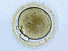 https://image.noelshack.com/fichiers/2024/16/7/1713703081-zygote1.jpg