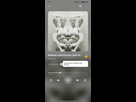 https://image.noelshack.com/fichiers/2024/25/7/1719134400-screenshot-2024-06-23-11-19-40-608-com-miui-player2.jpg