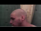 https://image.noelshack.com/fichiers/2024/28/6/1720884832-calvitie.png