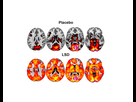 https://image.noelshack.com/fichiers/2024/29/1/1721066921-lsd-brain-imaging-study-2.png