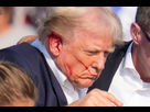https://image.noelshack.com/fichiers/2024/29/2/1721097431-13-410179e6f5414624aa32d3b688f8932f.jpg