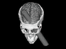 https://image.noelshack.com/fichiers/2024/29/6/1721455281-phineas-gage-cgi.jpg