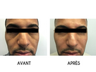 https://image.noelshack.com/fichiers/2024/30/4/1721901099-vallee-des-larmes-injections-thumb.jpg