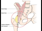 https://image.noelshack.com/fichiers/2024/31/5/1722605358-psoas1-jpg2.jpg