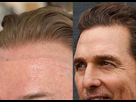 https://www.noelshack.com/2024-32-4-1723106832-matthew-mcconaughey-hairline-vs-wig.jpg