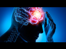 https://image.noelshack.com/minis/2024/33/7/1723978228-epilepsie-chronische-erkrankung-711x379-1.png