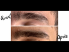 https://www.noelshack.com/2024-34-5-1724409933-avant-apres-sourcils-ore8xz53l1w5722im5zqzd7hwui4szd6bftejzysvg.png