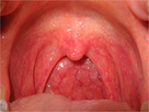 https://www.noelshack.com/2024-41-2-1728416476-pharyngitis.jpg