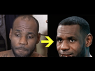 https://www.noelshack.com/2024-42-7-1729457910-lebron-james-greffe-de-cheveux-03.png