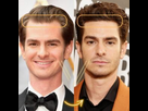 https://www.noelshack.com/2024-43-6-1729969039-andrew-garfield-hair-transplant-before-and-after-300x300.jpg