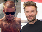 https://www.noelshack.com/2024-43-6-1729969072-david-beckham-greffe-de-cheveux-photo-avant-apres.jpg