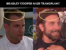 https://www.noelshack.com/2024-43-6-1729969179-bradley-cooper-hair-transplant-before-after-result.jpg