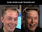 https://www.noelshack.com/2024-43-6-1729969248-elon-musk-hair-transplant-before-after.jpg