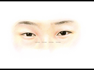 https://www.noelshack.com/2024-44-5-1730449683-asian-upper-eyelide-without-skin-fold.png