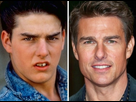 https://image.noelshack.com/fichiers/2024/49/3/1733339344-tom-cruise-chirurgie-esthetique-des-dents.jpg