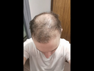 https://www.noelshack.com/2024-49-7-1733670171-nfn.jpg