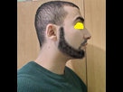 https://image.noelshack.com/fichiers/2024/52/4/1735224931-image.jpg