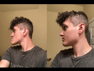 https://image.noelshack.com/fichiers/2025/07/1/1739204485-2-weeks-post-op-djs-for-19mm-und.jpg