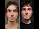 https://image.noelshack.com/fichiers/2025/07/1/1739204982-before-after-facial-symmetrisati.jpg
