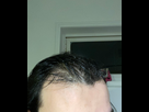 https://image.noelshack.com/fichiers/2025/09/3/1740602536-img-6301.jpeg
