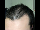 https://image.noelshack.com/fichiers/2025/09/3/1740602733-img-6302.jpeg