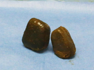 https://www.noelshack.com/2025-09-4-1740624168-cover-r4x3w1200-5bfd5e26a0cd2-crotte-wombat.jpg