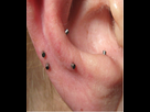 https://image.noelshack.com/fichiers/2025/16/6/1745079966-photo-auriculotherapie-2.jpg