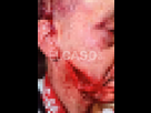 https://image.noelshack.com/fichiers/2025/19/2/1746534716-ferit-agressio-discoteca-barcelona.jpeg