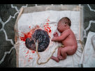 https://image.noelshack.com/fichiers/2025/21/3/1747780734-newborn-baby-attached-to-heart-shaped-placenta.jpg
