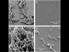 https://image.noelshack.com/fichiers/2025/30/1/1753052100-scanning-electron-microscopy-of-streptococcus-constellatus-fh20-biofilms-treated-with.png