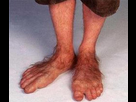 https://image.noelshack.com/fichiers/2025/39/5/1758893918-15-photos-des-pieds-les-plus-tranges-que-vous-allez-voir-de-votre-vie-la-derni-re-est-vomir-14-768x663.jpg